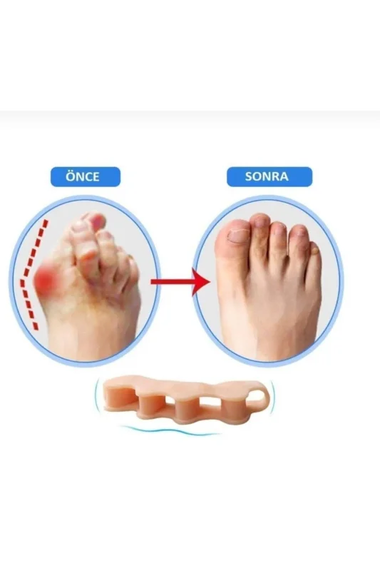 1 Çift Ayak 5 Parmak Ayırıcı Aparat